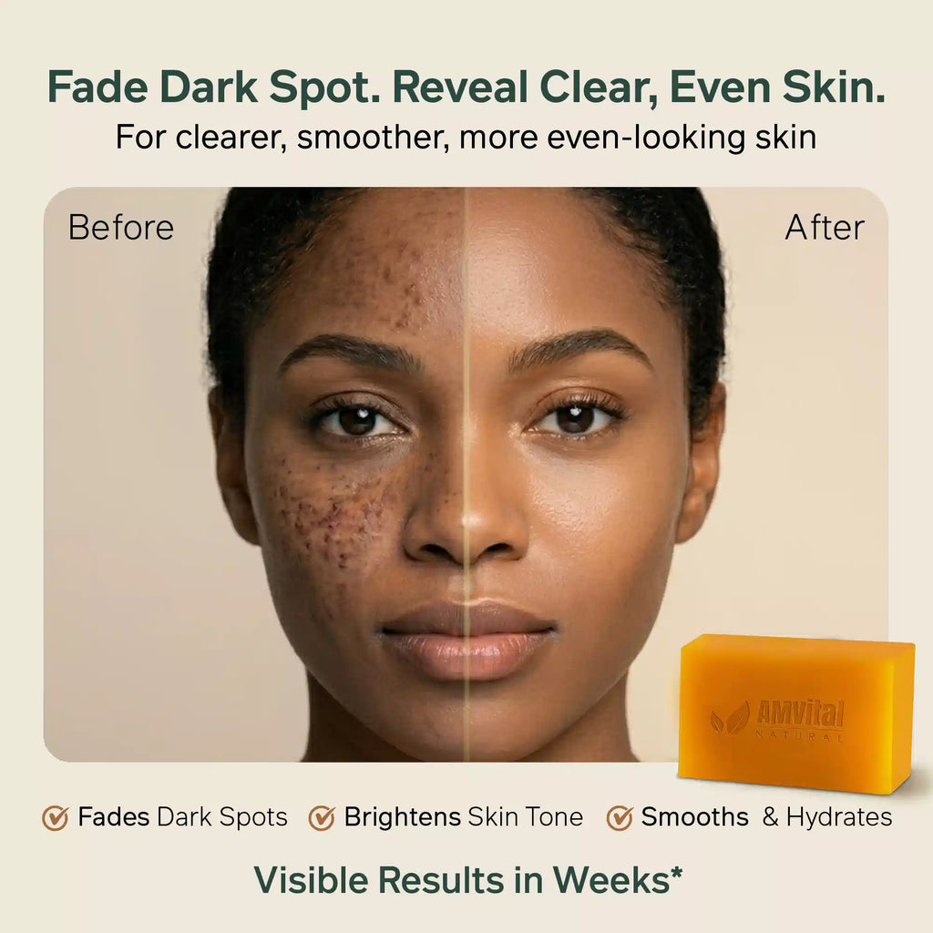 AMVital Turmeric Kojic Acid Soap Bar for Dark Spots & Uneven Tone - Fabs things