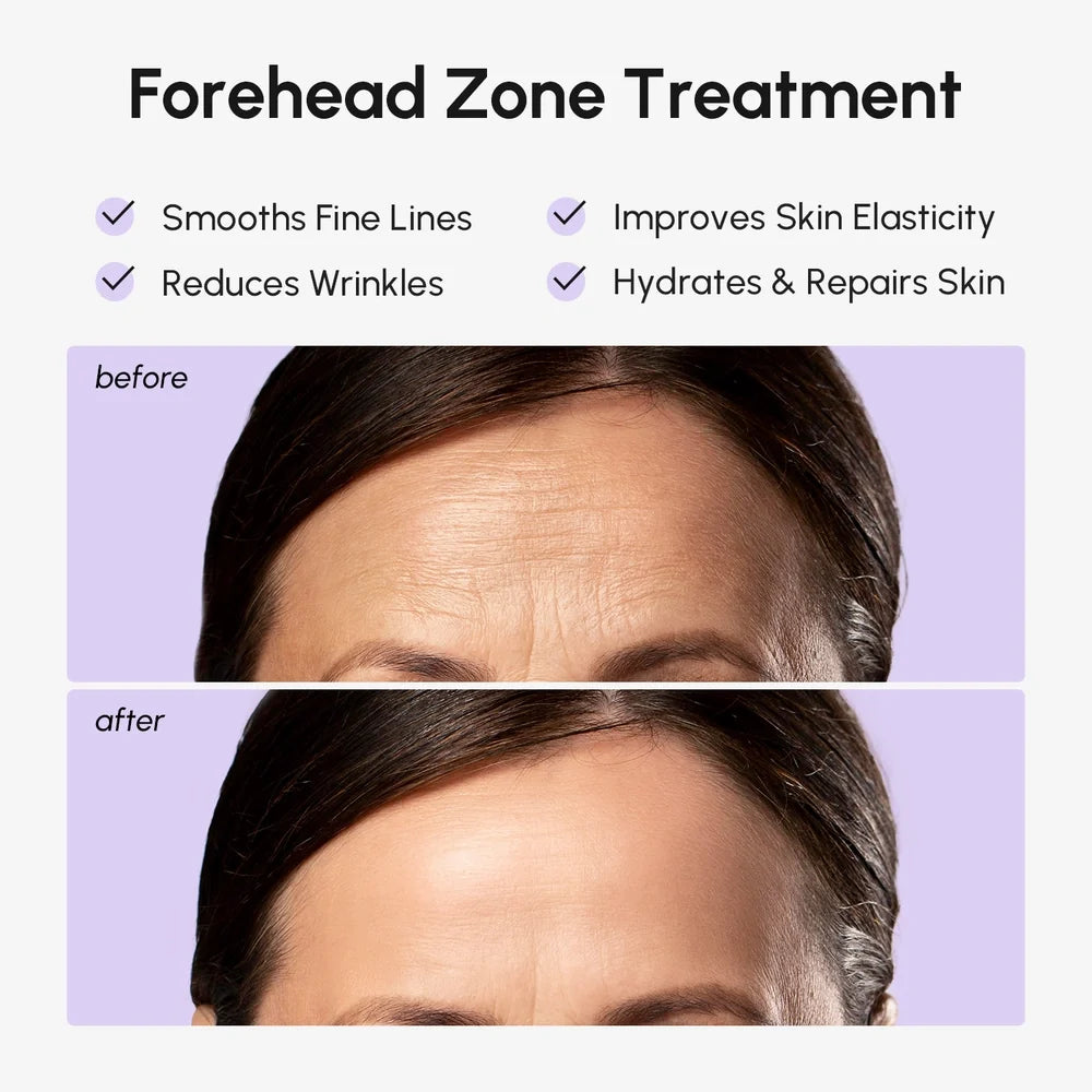 Anti-Wrinkle Forehead Patches - Fabs things