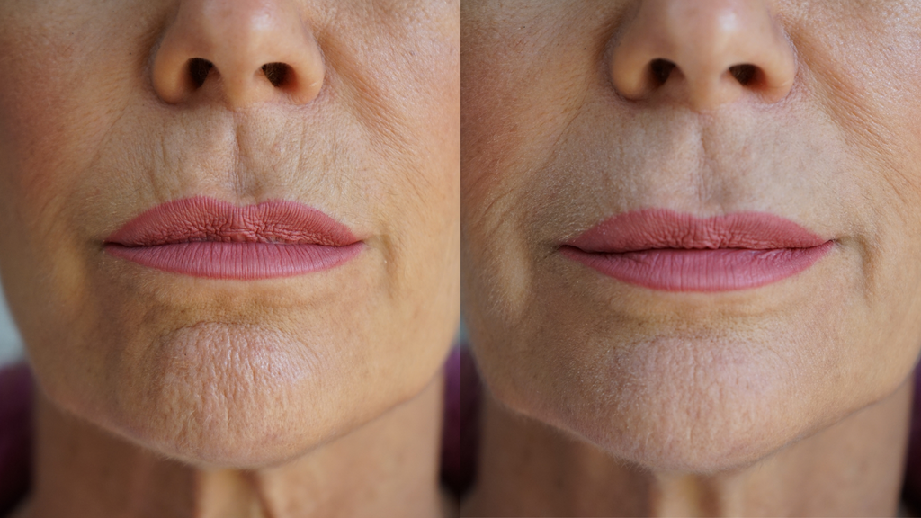 Ageless Lip & Line Filler - Fabs things