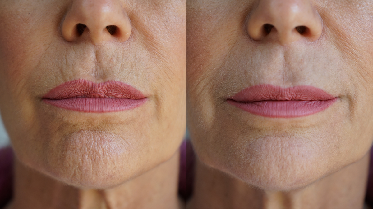 Ageless Lip & Line Filler - Fabs things